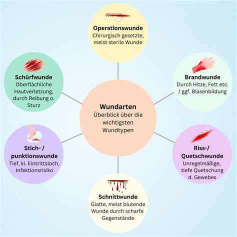 Schema, das die verschiedenen Ursachen eines wunden Pos bei Babys darstellt (Ernährung, Zähne, Windelwechsel etc.)