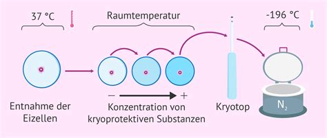 Schema der Vitrifizierung und des Auftauens von Embryonen