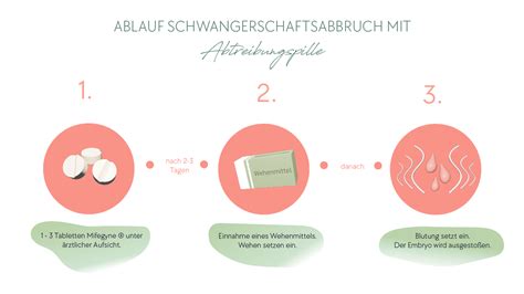 Infografik zum Ablauf der medikamentösen Abtreibung