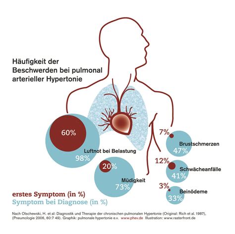 Illustrationsbeispiel für pulmonale Hypertonie