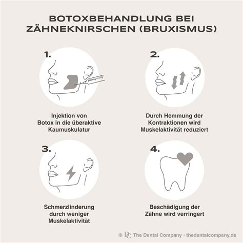 Schema zur Darstellung von Ursachen und Folgen von Bruxismus