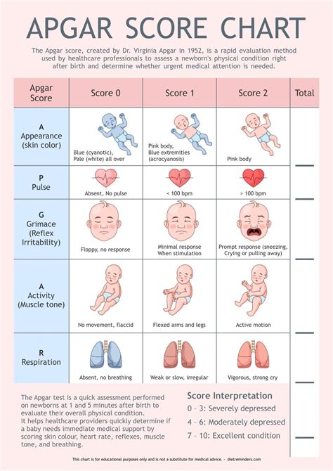 Infografik zur Berechnung des Apgar-Scores