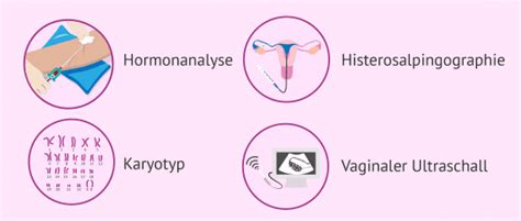 Grafik, die den altersbedingten Rückgang der weiblichen Fertilität darstellt.