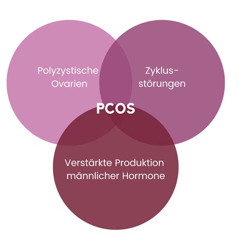 Infografik mit den typischen Symptomen des PCOS