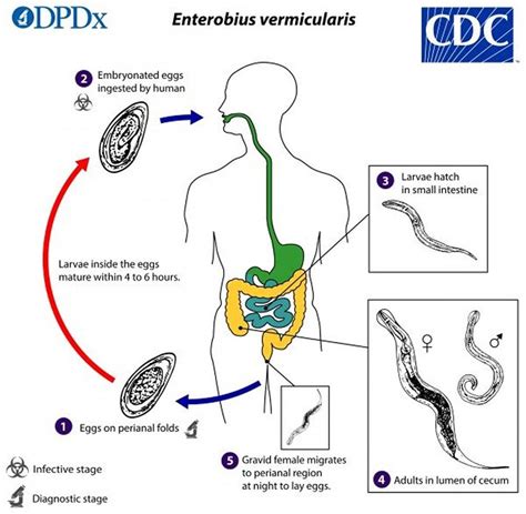 Schema des Lebenszyklus von Enterobius vermicularis, das die Übertragung durch Eier und die Wanderung des Wurms im Darm zeigt.