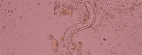 Detailansicht eines Mikroskopbildes von Madenwurm-Eiern auf einem Klebestreifen.