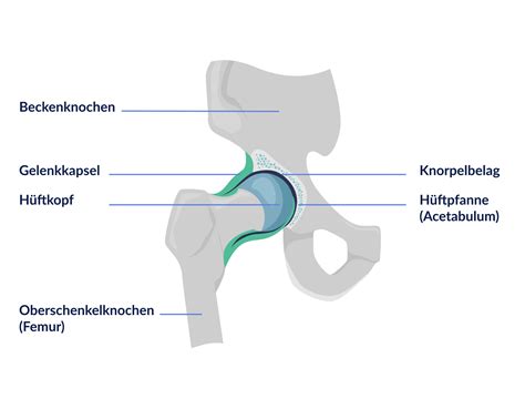 Schema des kindlichen Hüftgelenks mit Pfanne und Kopf