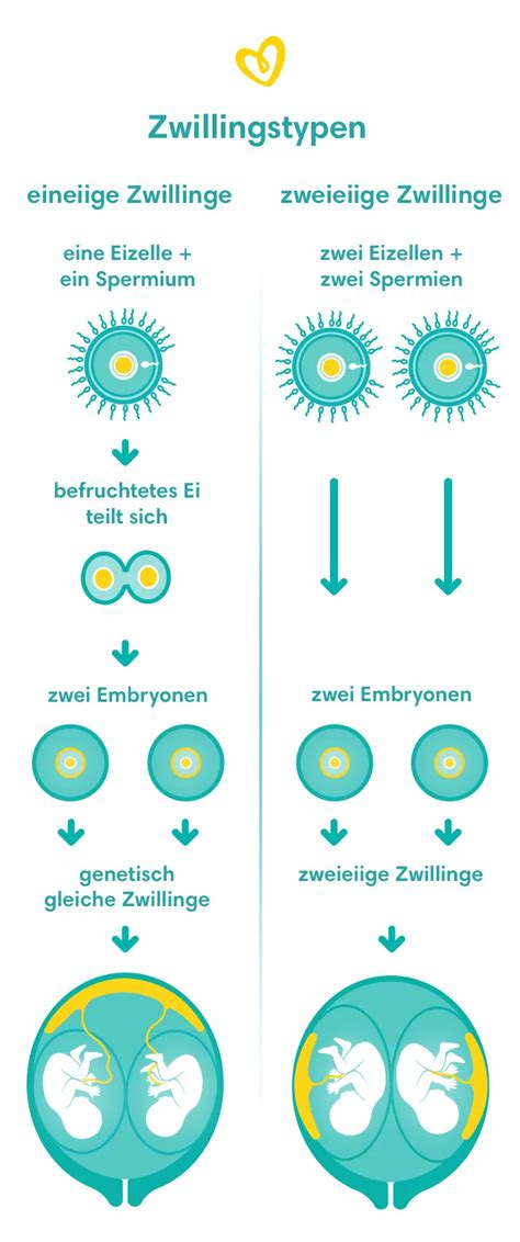 Illustration von Zwillingen, die medizinisch betreut werden