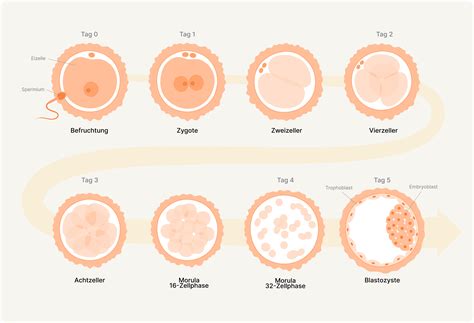 Schema des IVF-Prozesses