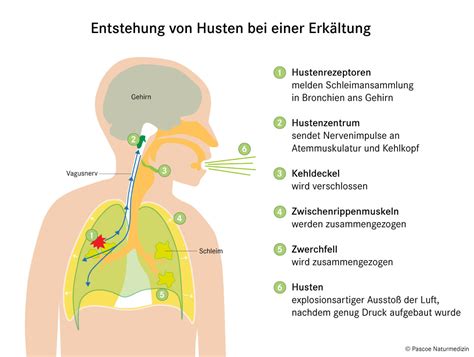 Eine Grafik, die die verschiedenen Behandlungsmöglichkeiten bei pfeifendem Husten bei Kindern darstellt.