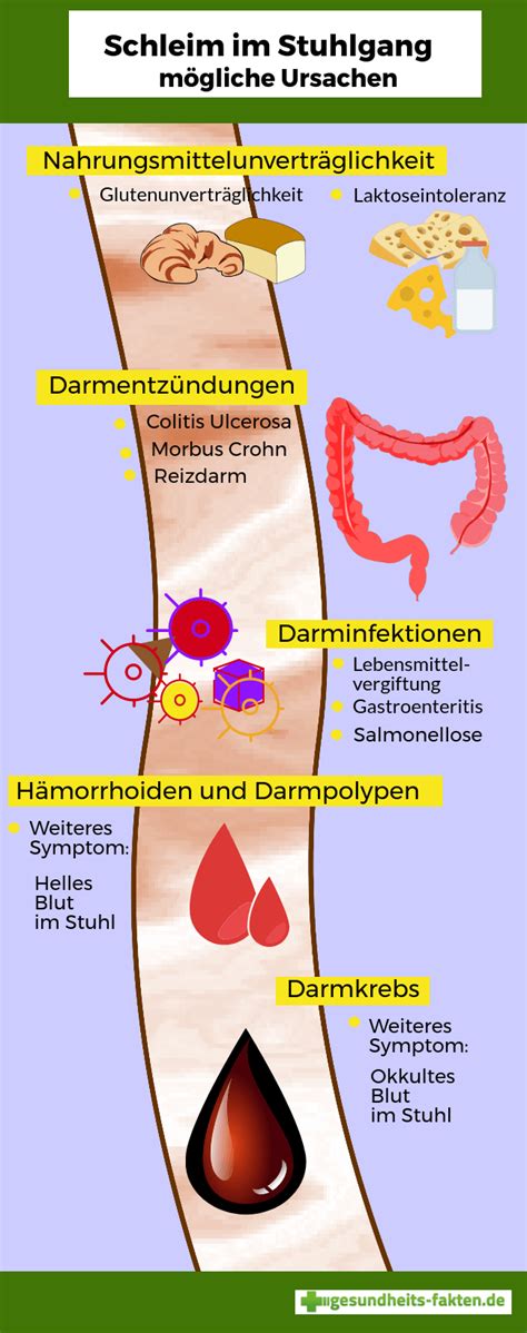 Infografik: Farben von Schleim im Stuhl und mögliche Ursachen