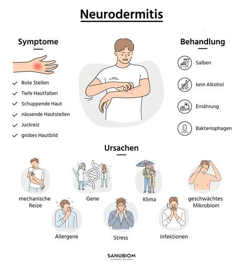 Illustration, die typische Stellen für Neurodermitis-Symptome am Körper zeigt.