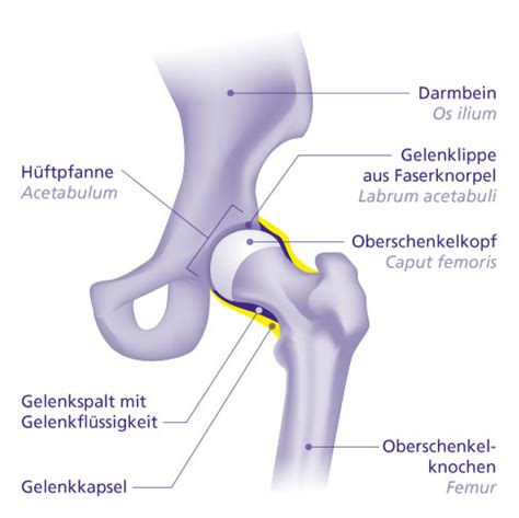 Detailansicht der Tübinger Schiene, die die Beinschalen und die Spreizverbindung zeigt.