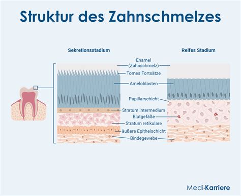 Schema der Zahnstruktur mit Hervorhebung von Zahnschmelz und Dentin