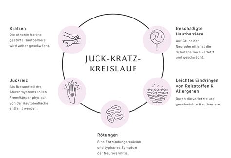 Grafik, die den Juck-Kratz-Kreislauf bei Neurodermitis veranschaulicht.