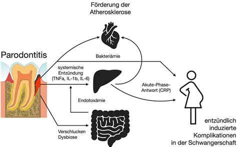 Schema zur Verdeutlichung der Nabelbewegung beim Feueratem.