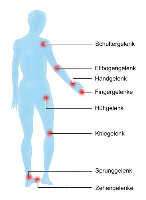 Illustration von Kinderbeinen mit schmerzenden Stellen, die typische Lokalisationen von Wachstumsschmerzen zeigen.