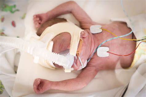 Neugeborenes in der Neonatologie unter medizinischer Überwachung