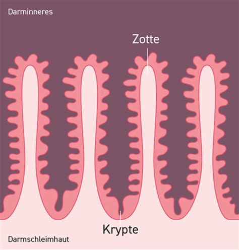 Schema der Gebärmutter mit Hervorhebung des Gebärmutterhalskanals und der Krypten, in denen Zervixschleim gebildet wird.