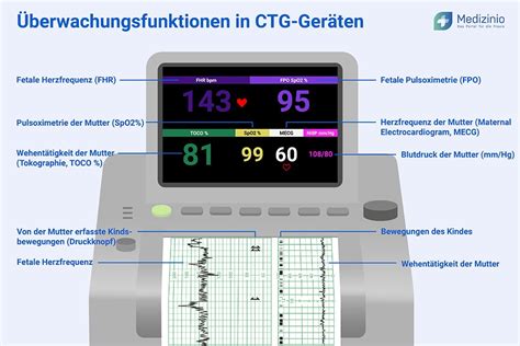 grafik mit einem CTG-Gerät und stilisierten Herzfrequenzen