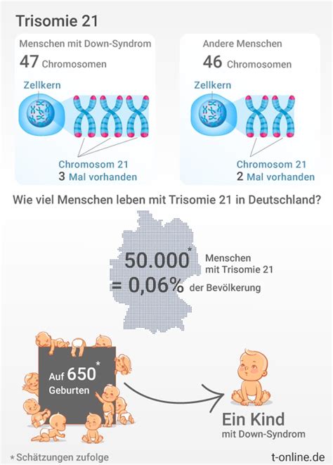 Grafik, die die Häufigkeit verschiedener gesundheitlicher Beeinträchtigungen bei Trisomie 21 zeigt