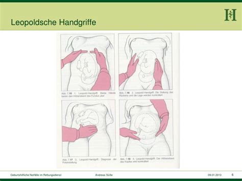 Schema der Leopold-Handgriffe zur Bestimmung der Kindslage