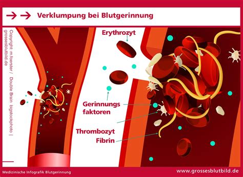 Schema zur Wirkung von Methylergometrin auf die Gebärmutterkontraktion und Gefäßverengung