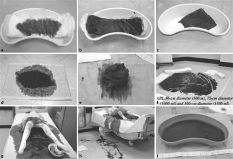 Illustrative Grafik, die den Blutverlust bei vaginaler Geburt und Kaiserschnitt vergleicht.