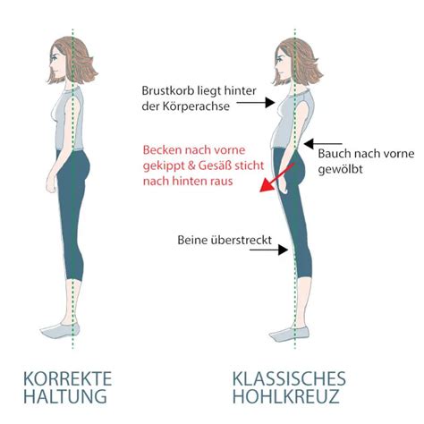 Illustration, die die Hohlkreuzhaltung einer Schwangeren zeigt und wie der BabyBelt diese korrigieren kann