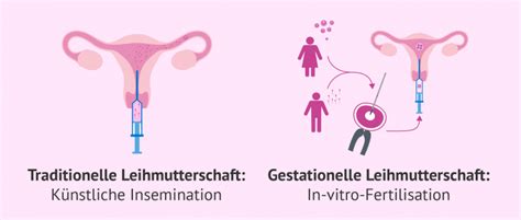 Schema der verschiedenen Rollen und Beziehungen bei Leihmutterschaft: Bestelleltern, Leihmutter, Eizellspenderin, Samenspender, Kind.