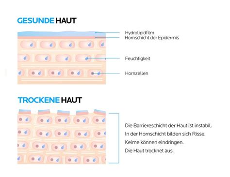 Schema der Hautschutzbarriere und wie das Pflegeöl diese unterstützt