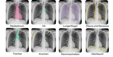 Vergleich von digitalem Röntgenbild und Ultraschallbild