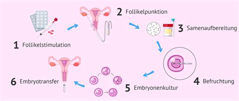 Schema der In-Vitro-Fertilisation (IVF)