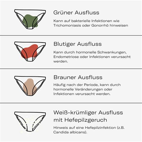 farbvergleich von fruchtwasser, urin und ausfluss