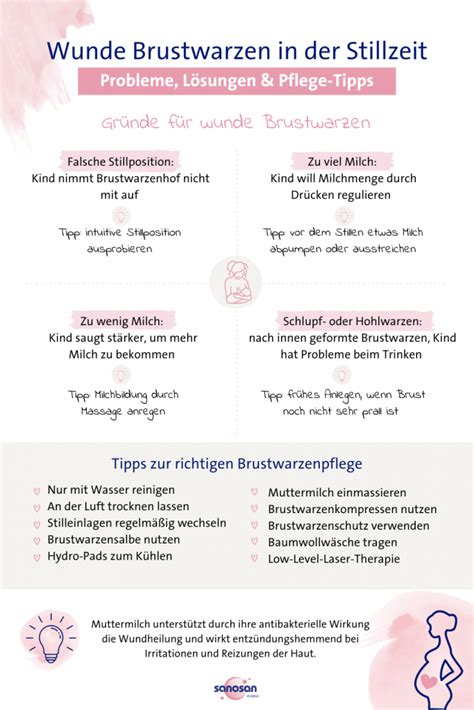 Schema der Anlegetechnik beim Stillen, um wunde Brustwarzen und Milchstau zu vermeiden.