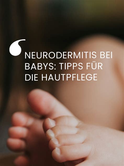Nahaufnahme von Babyhaut mit einer sanften Behandlung von Hautirritationen durch Muttermilch.