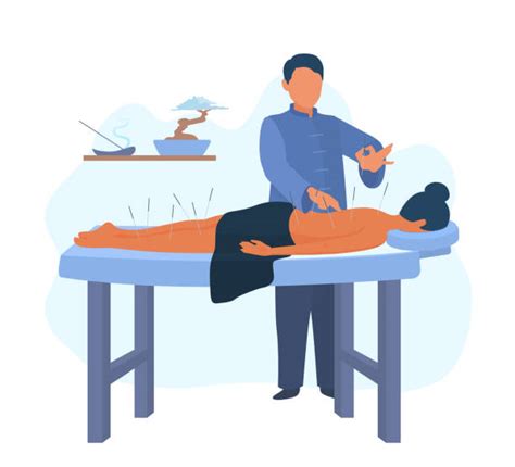 Illustration einer Akupunkturbehandlung