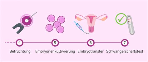 Schematische Darstellung des IVF-Prozesses von der Stimulation bis zum Embryotransfer