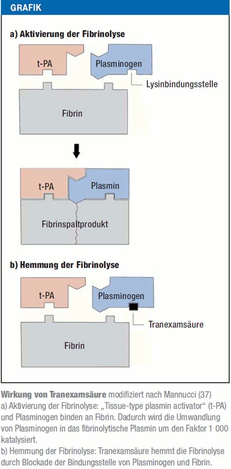 Schematische Darstellung der Wirkungsweise von Tranexamsäure auf die Fibrinolyse