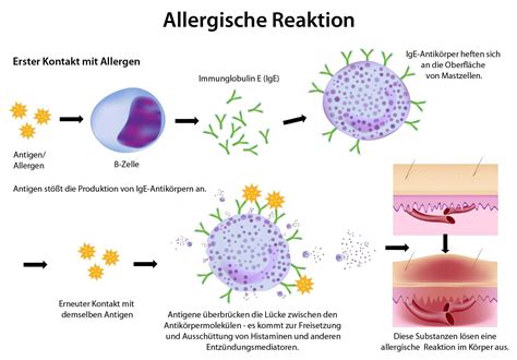 Symbol für eine allergische Reaktion