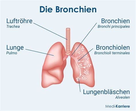 Grafik zur Veranschaulichung der Bronchiolen und ihrer Verengung bei Bronchiolitis