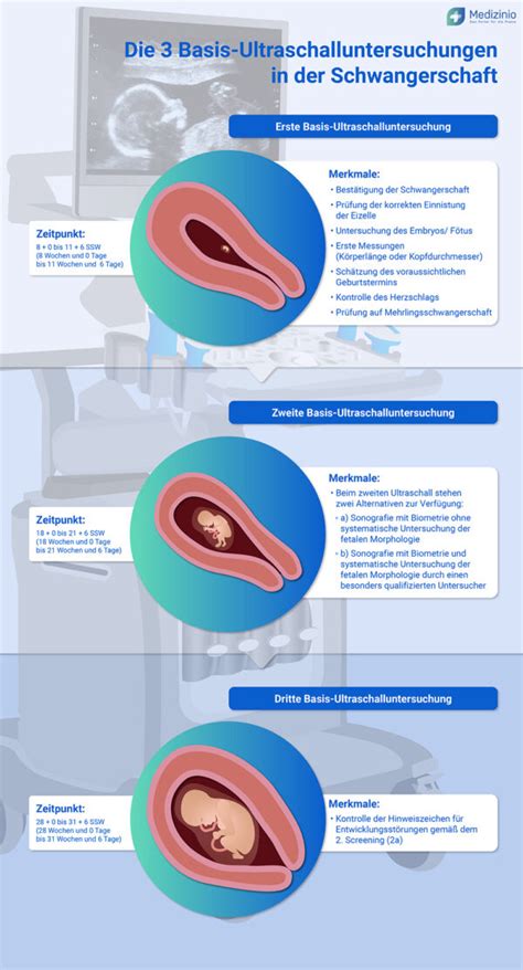 Infografik: Phasen der Schwangerschaft und Wochenbettbetreuung durch eine Hebamme
