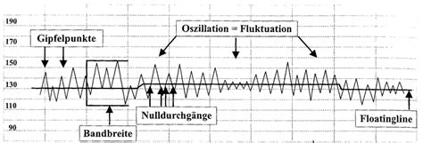 Infografik, die die verschiedenen Parameter des FIGO-Scores (Grundfrequenz, Oszillation, Akzeleration, Dezeleration) visuell darstellt.