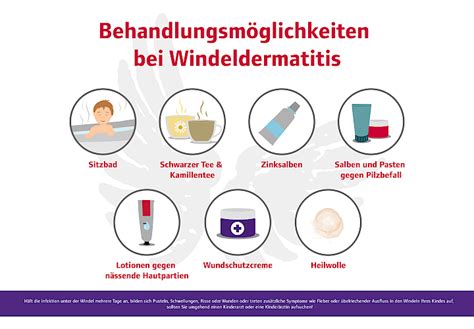 Infografik: Die ABCDE-Regeln zur Vorbeugung von Windeldermatitis